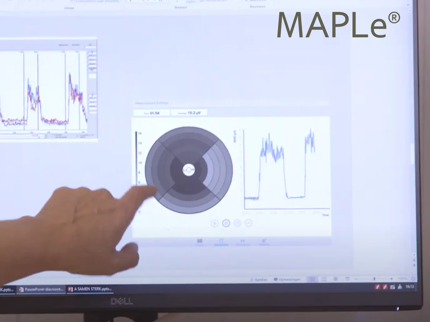 MAPLe regional muscle activity on screen in the CoreGood clinic, with Nathan pointing to the pelvic floor map